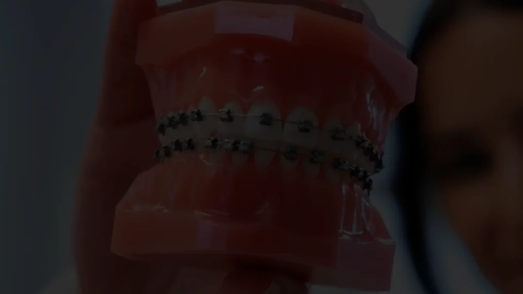 Ortodontia: Esclarecendo as Dúvidas mais Comuns dos Pacientes