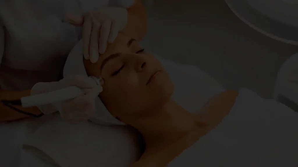 Laser Lavieen na Estética Facial – O que é? E quais os benefícios?